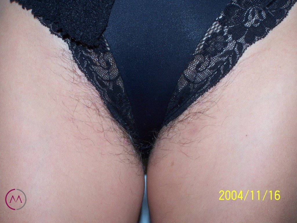Before image