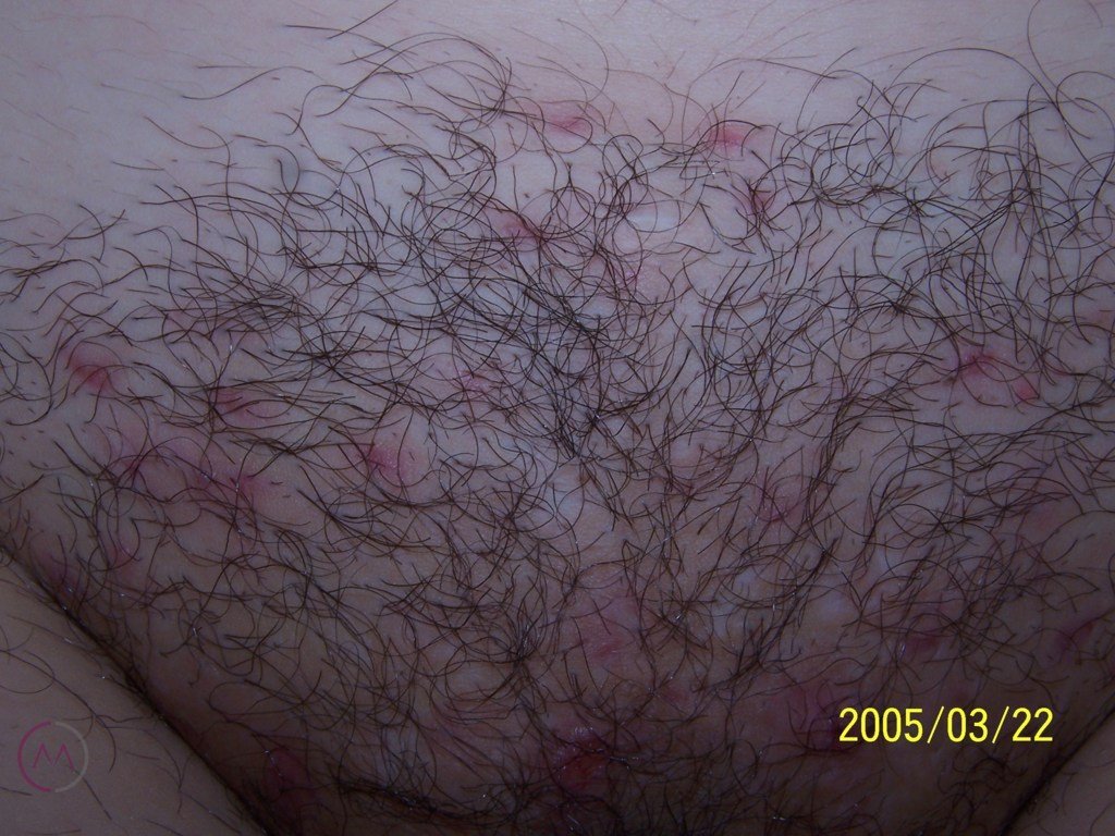 Before image