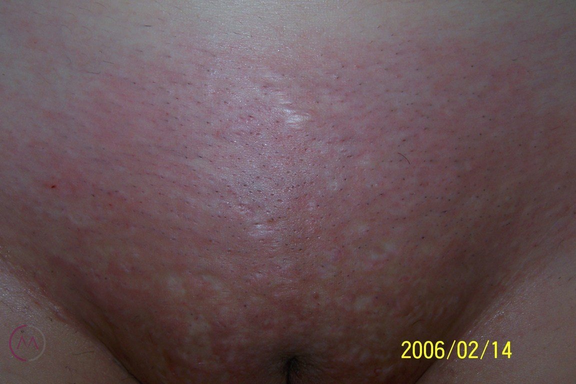 After image