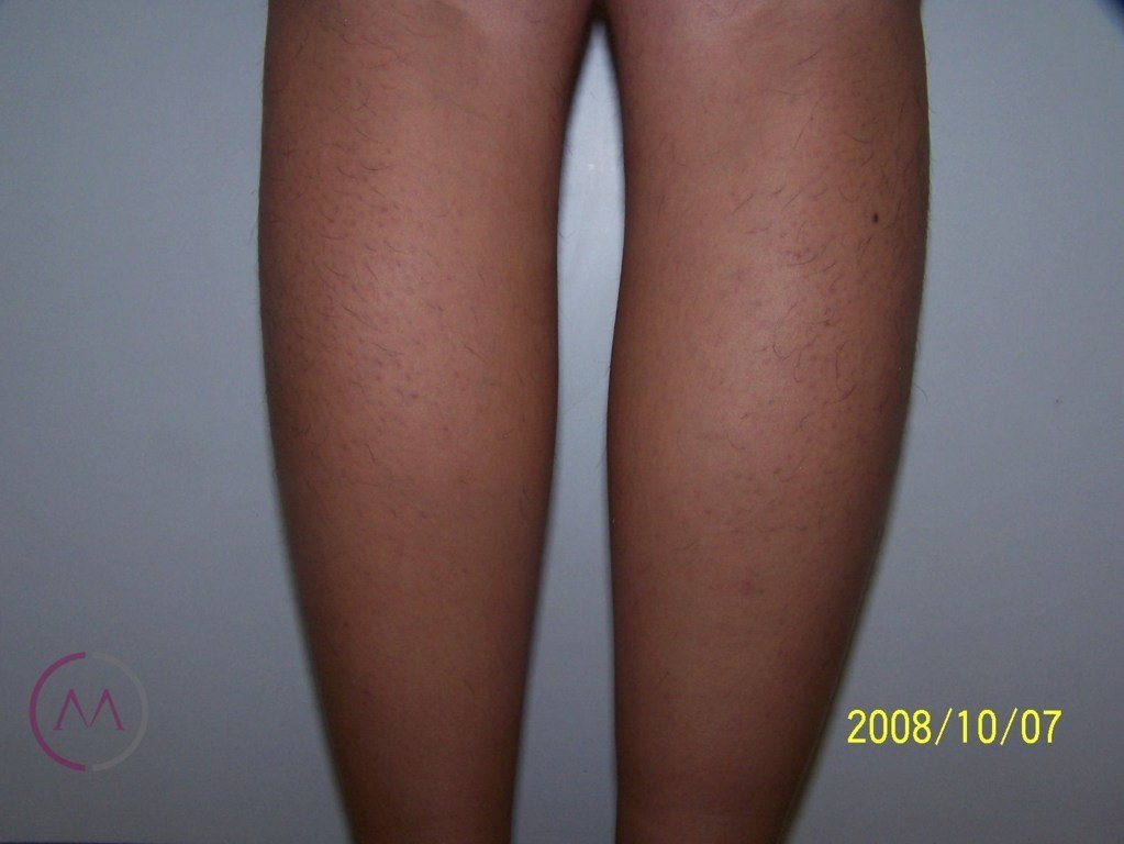 Before image