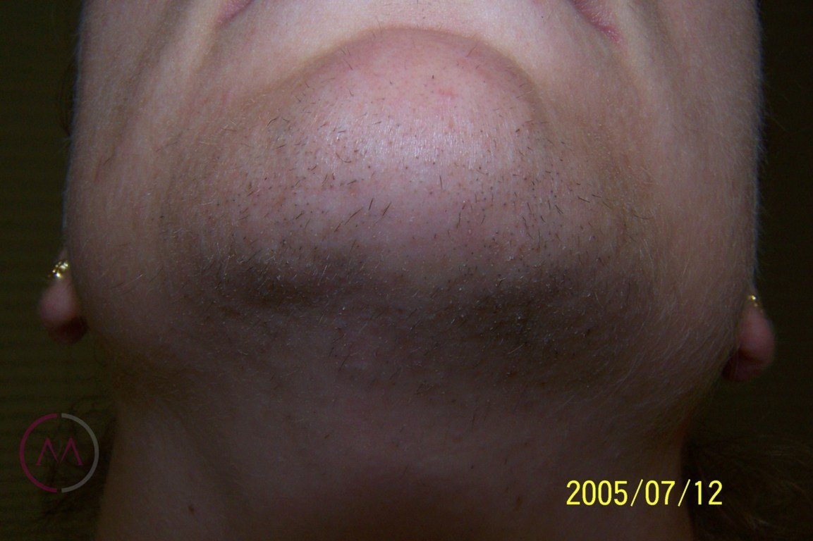 Before image