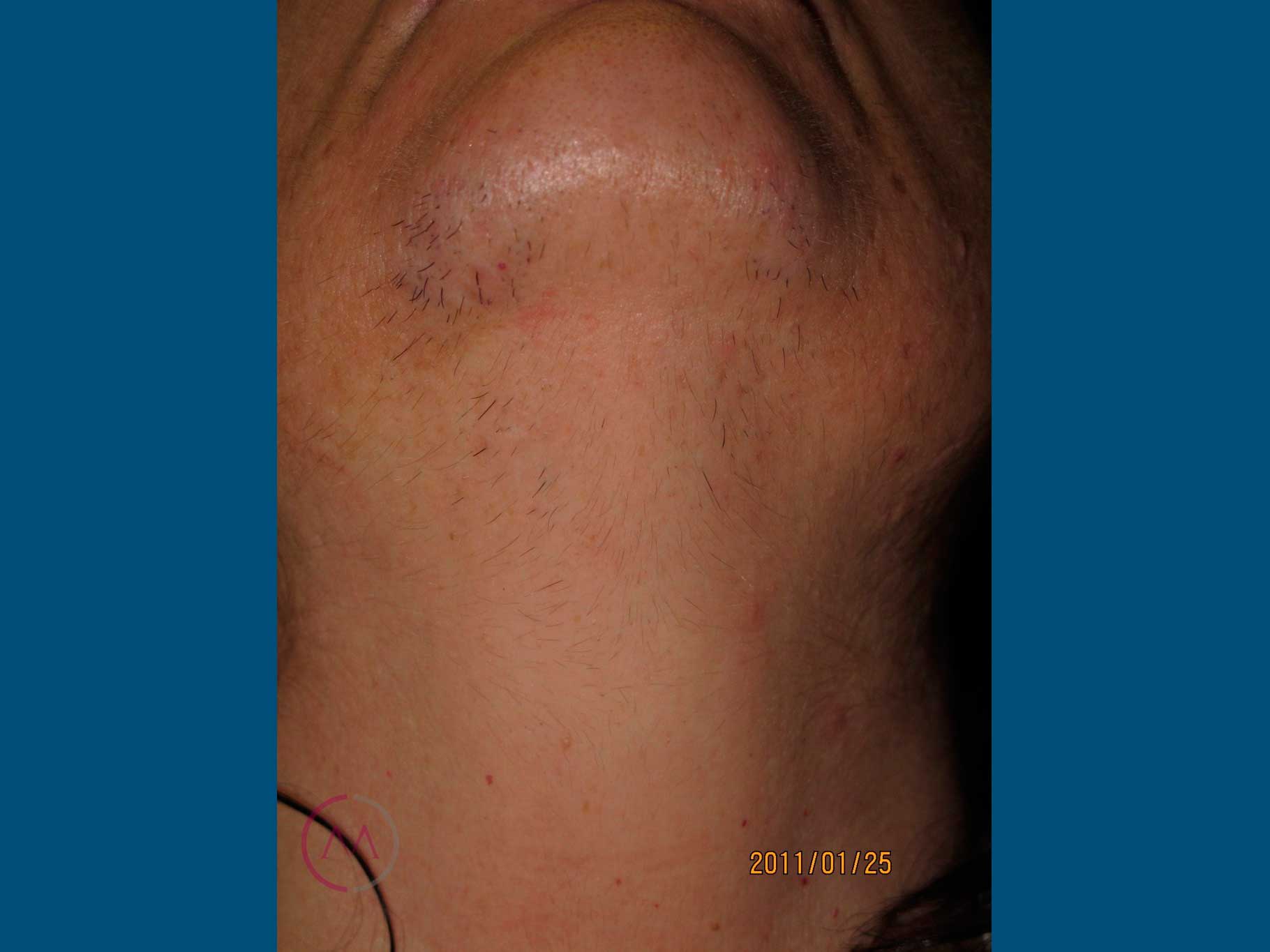 Before image