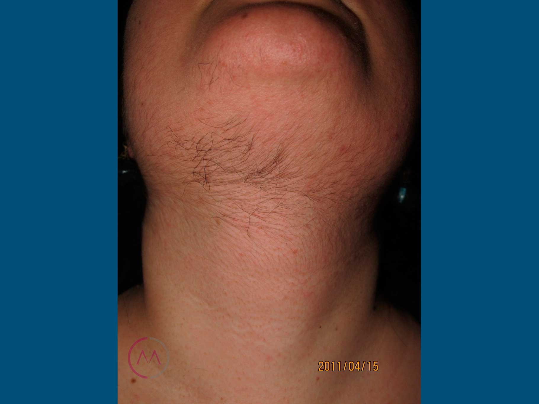Before image