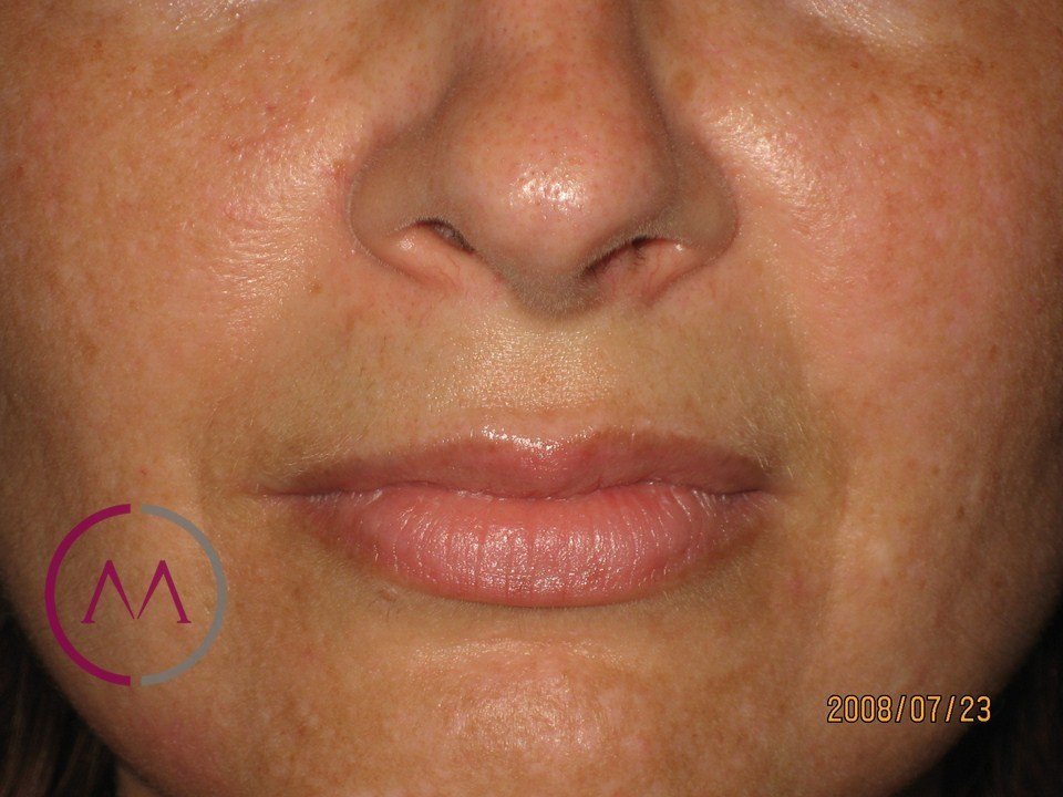 Before image