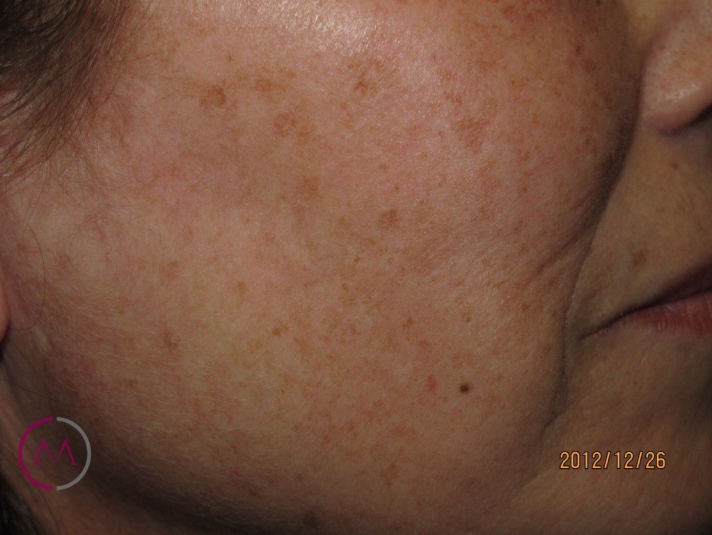 Before image