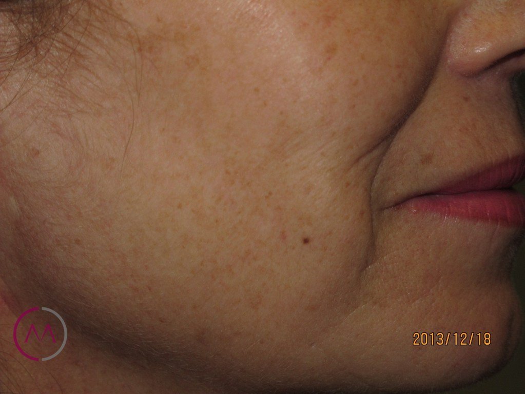 After image