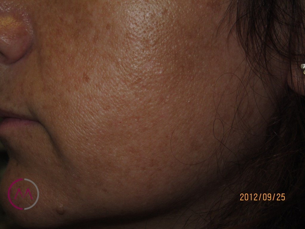Before image
