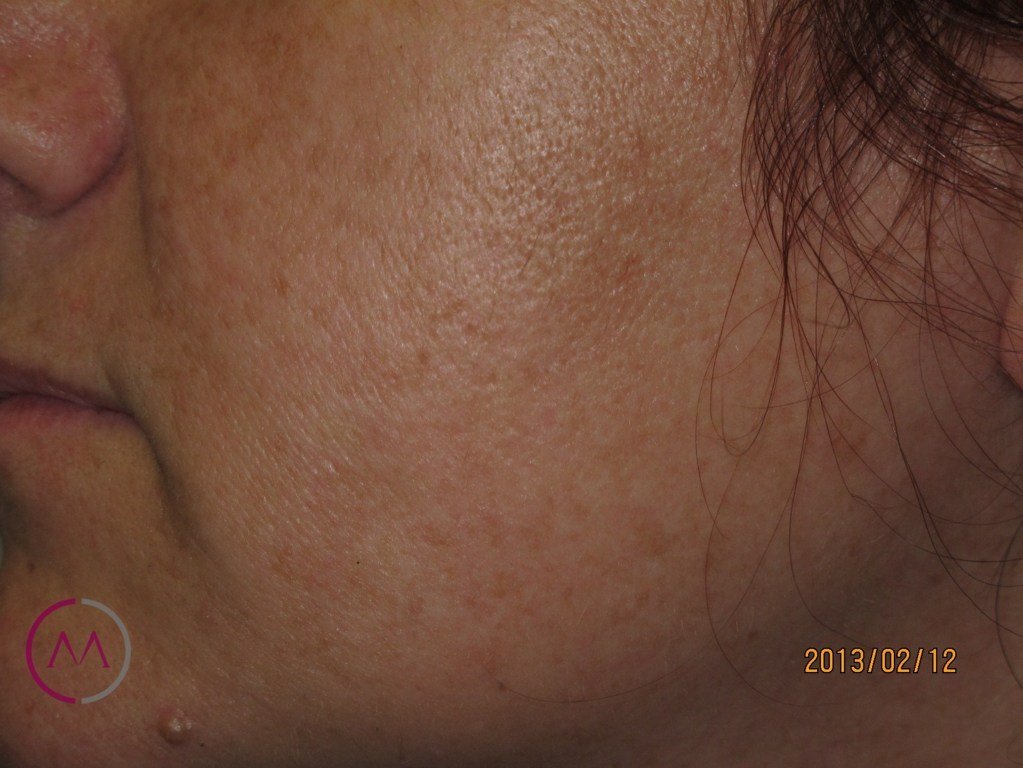 After image