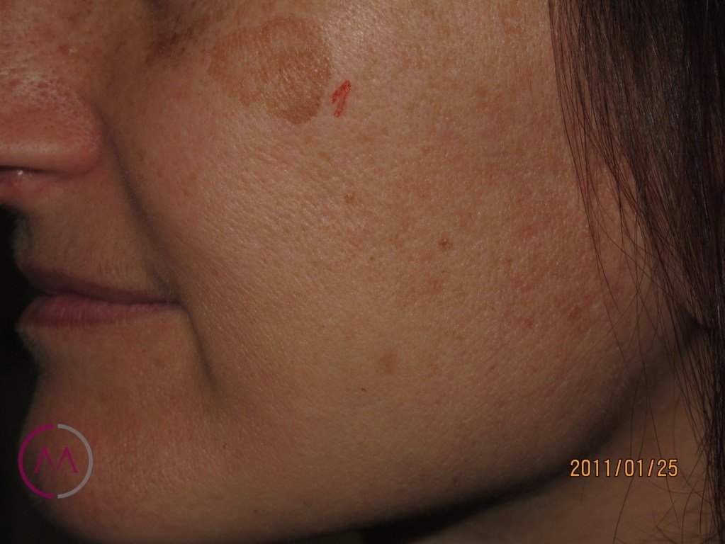 Before image