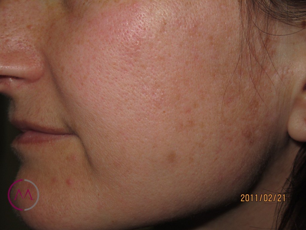 After image
