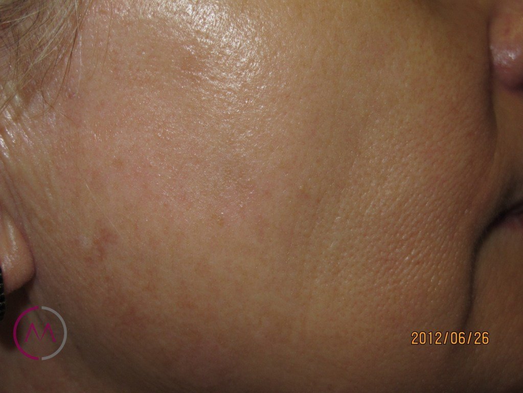 After image