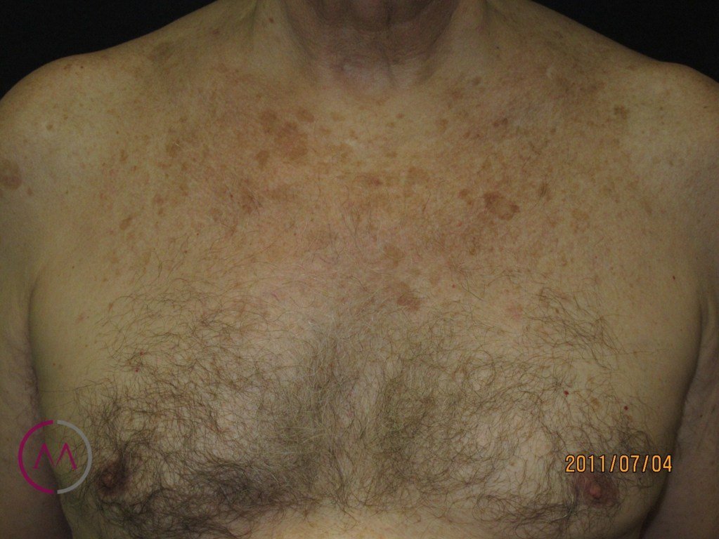 Before image