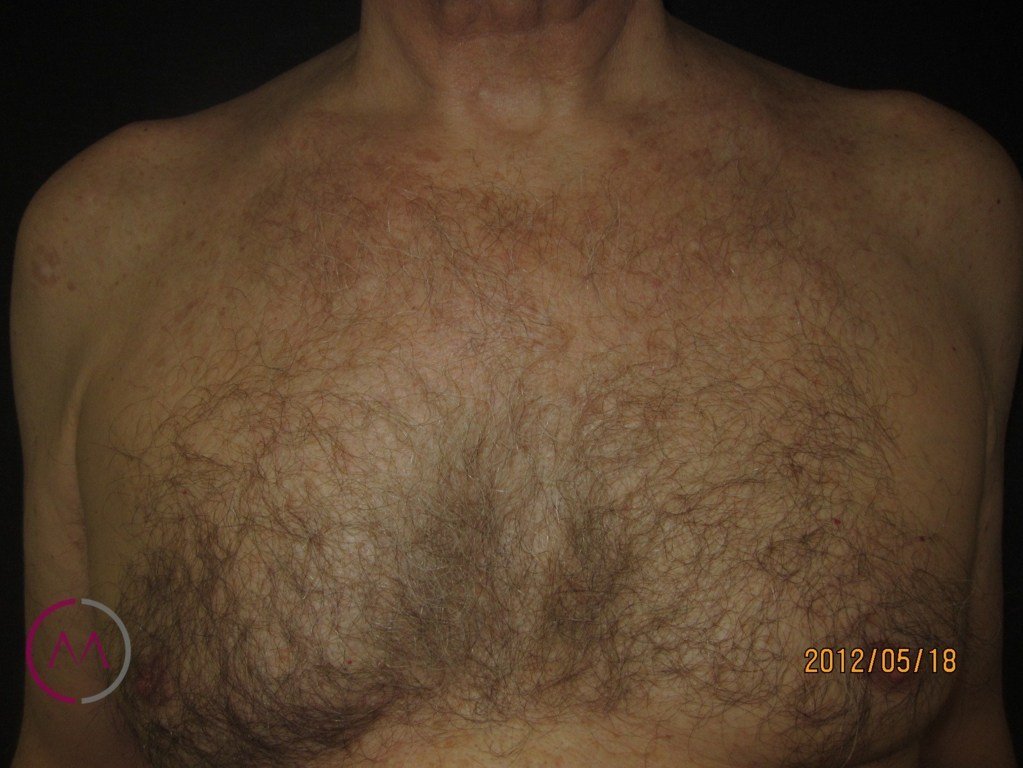 After image