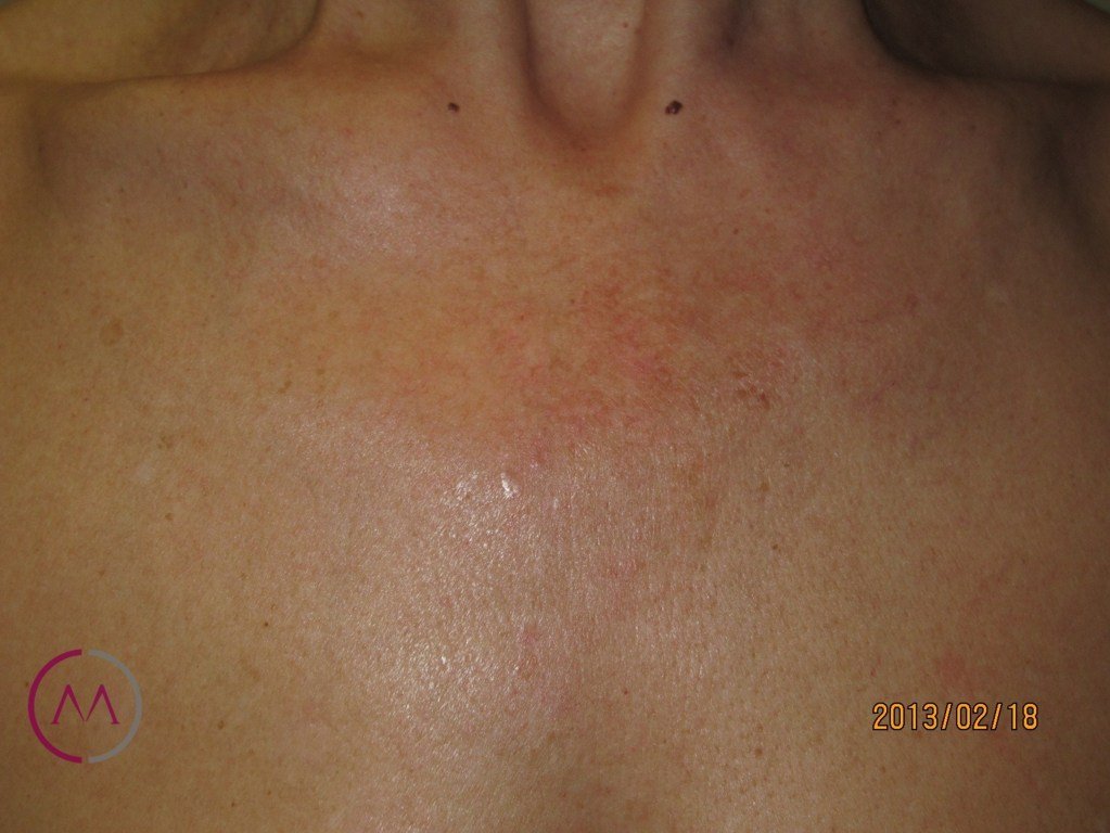 After image