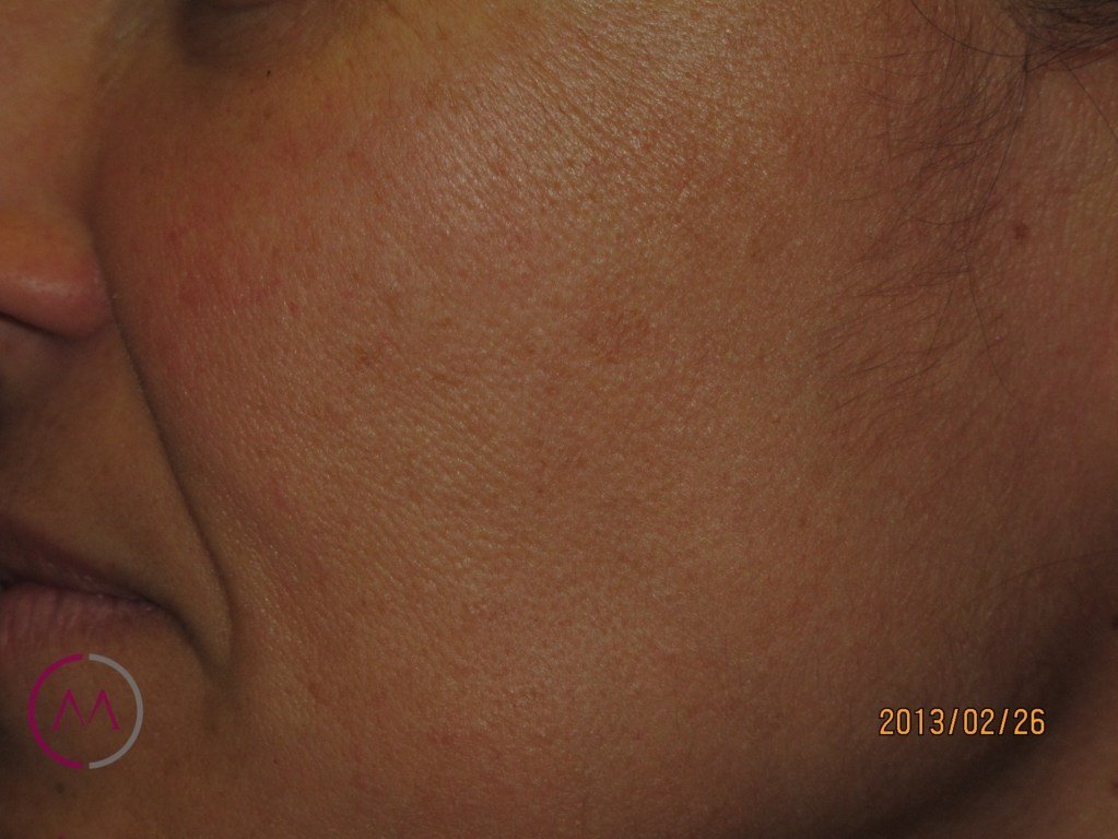 After image