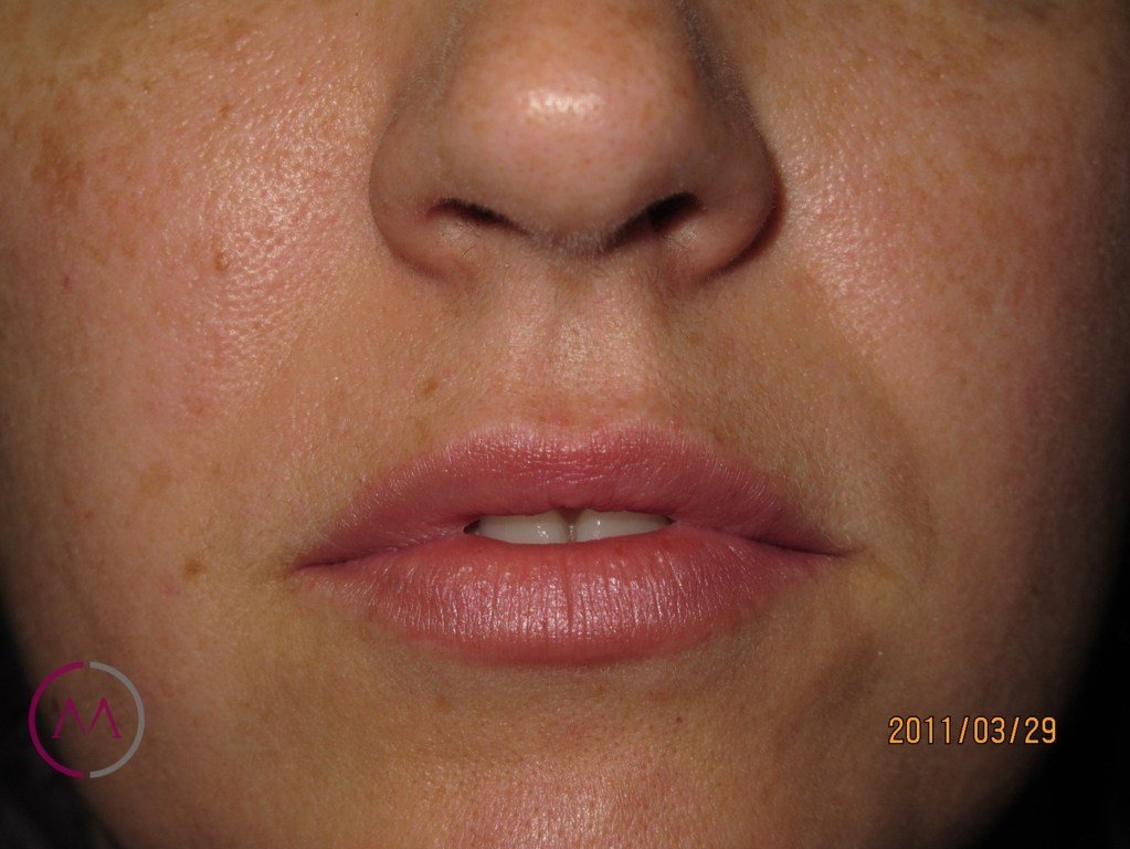 After image