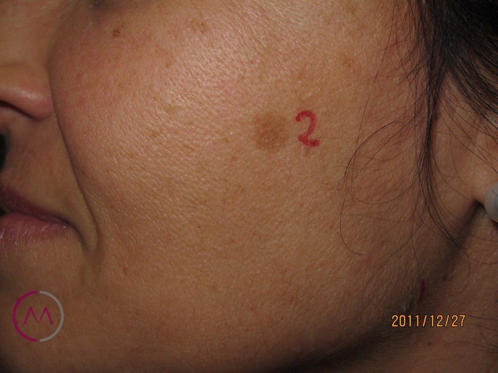 Before image