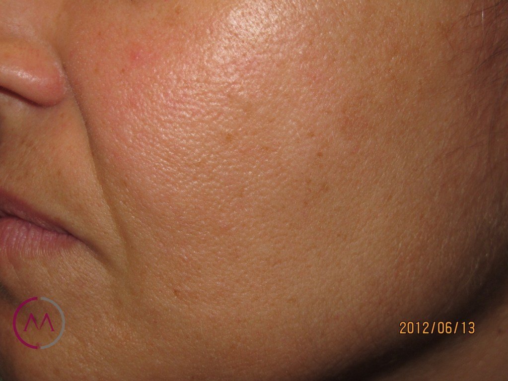 After image