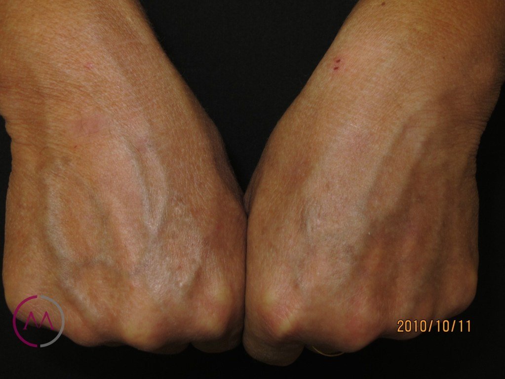 After image