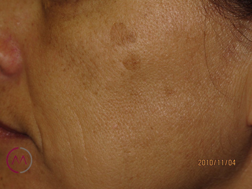 Before image