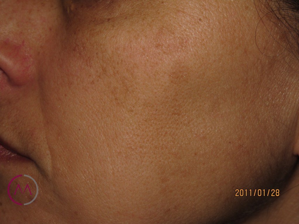 After image