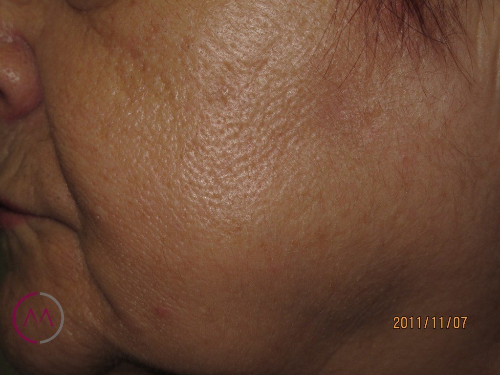 After image