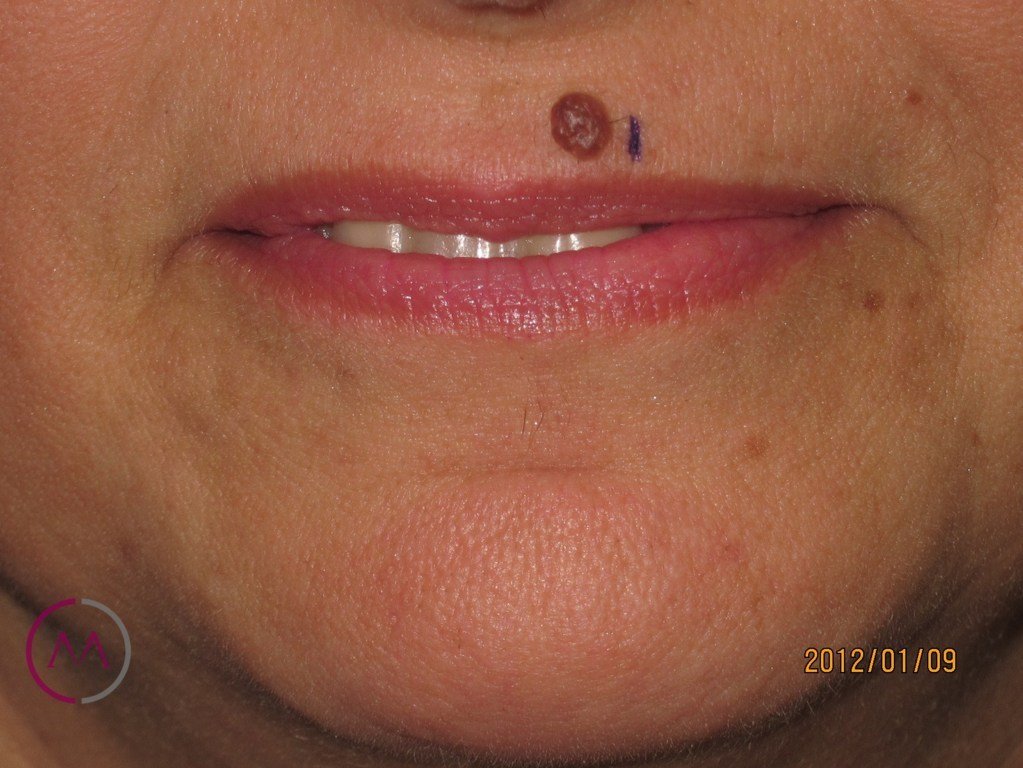 Before image