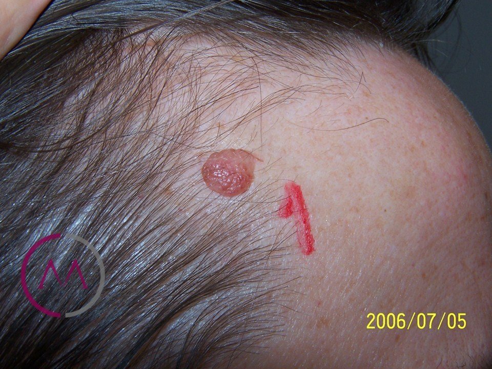 Before image