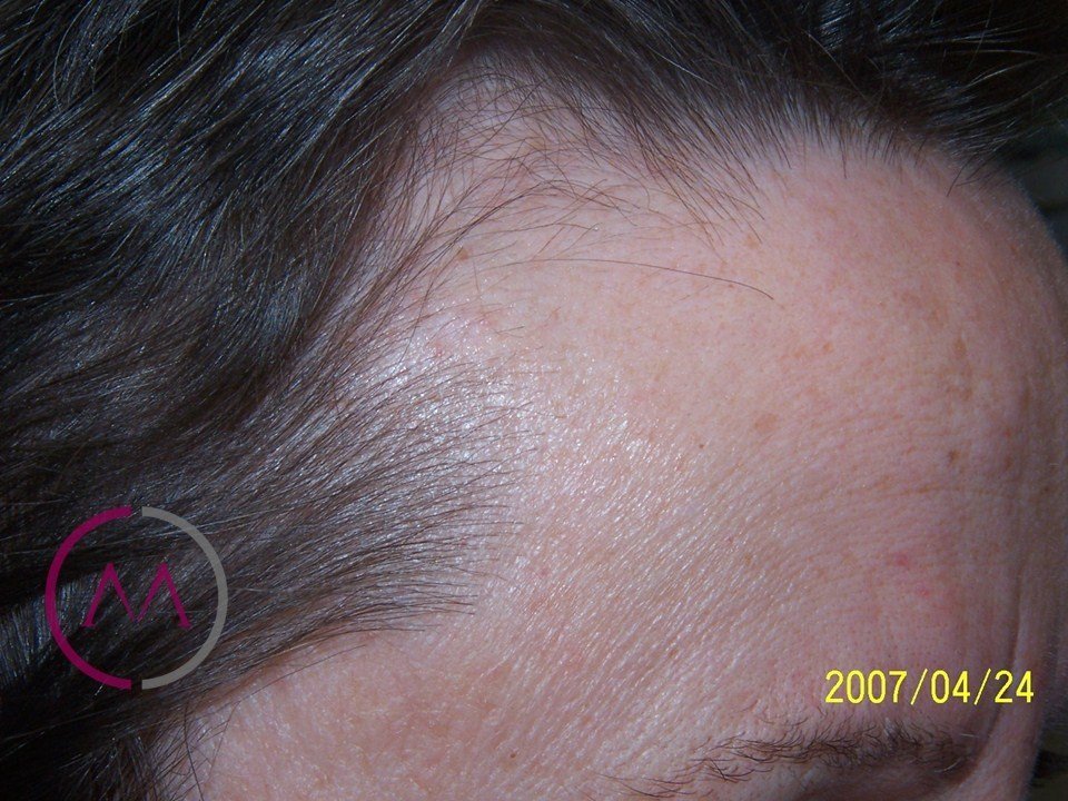 After image