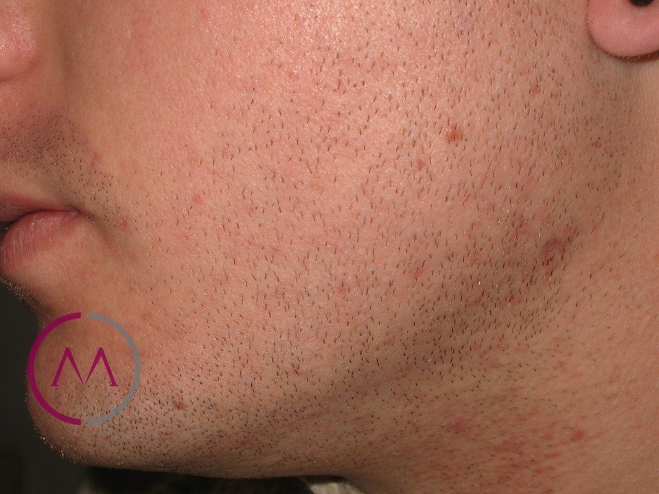 After image