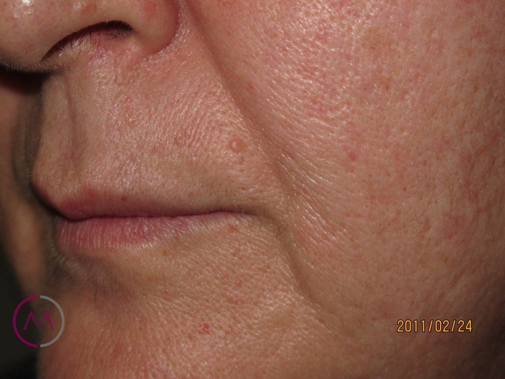 After image