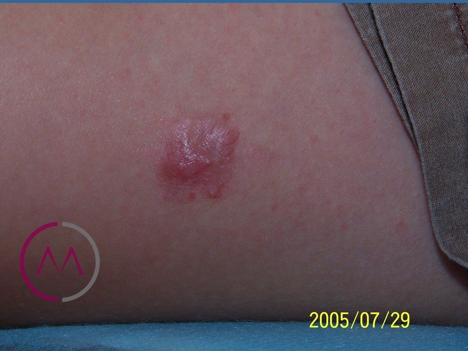 Before image