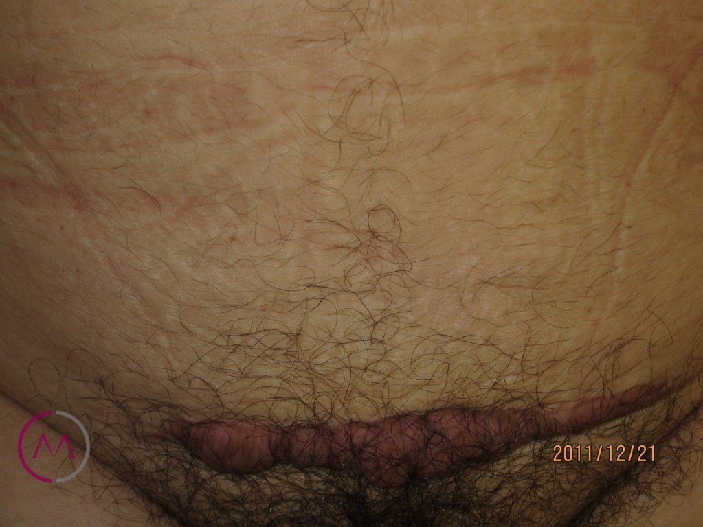 Before image