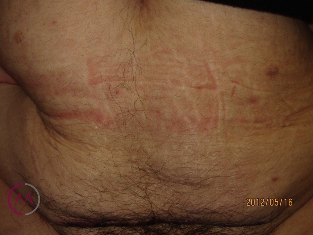 After image
