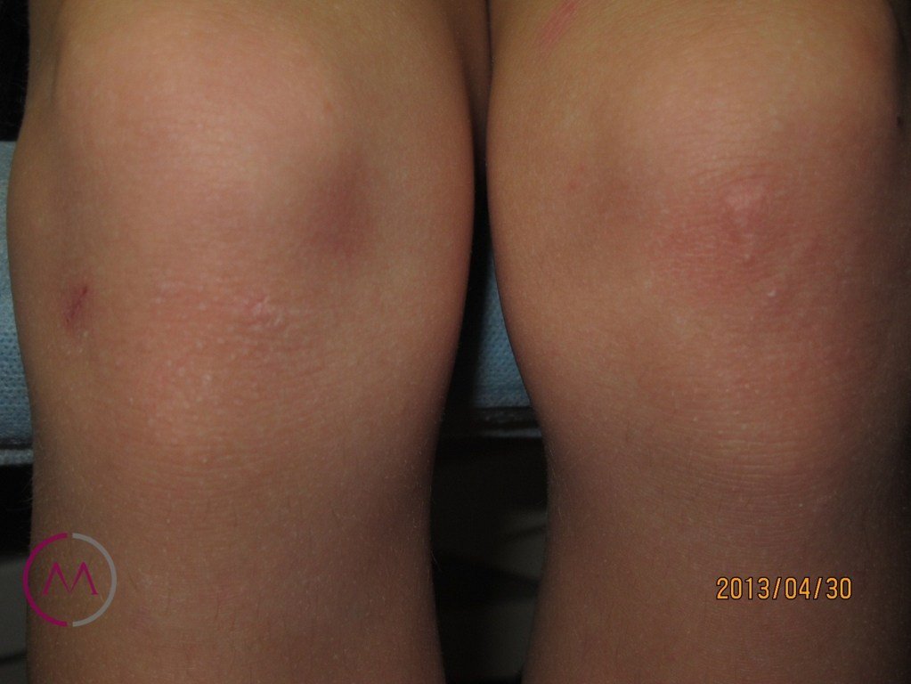 After image