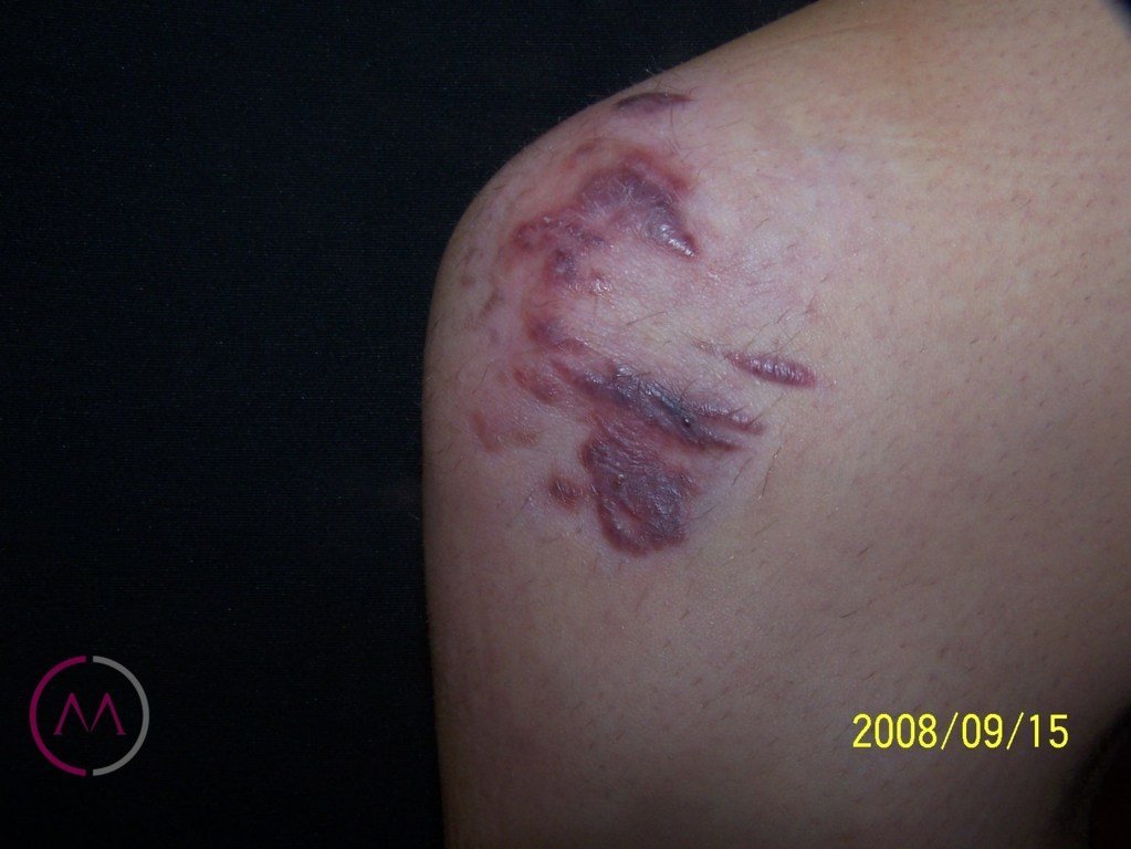 Before image