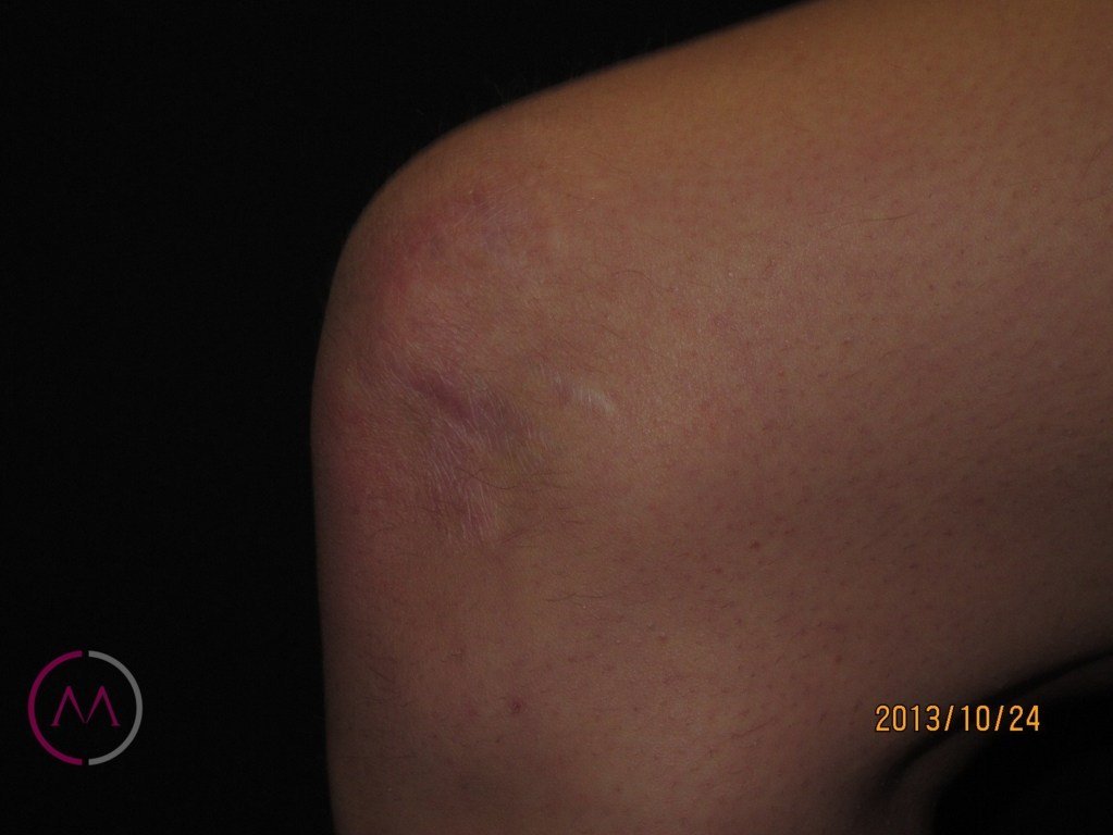 After image