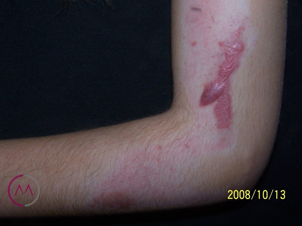 Before image