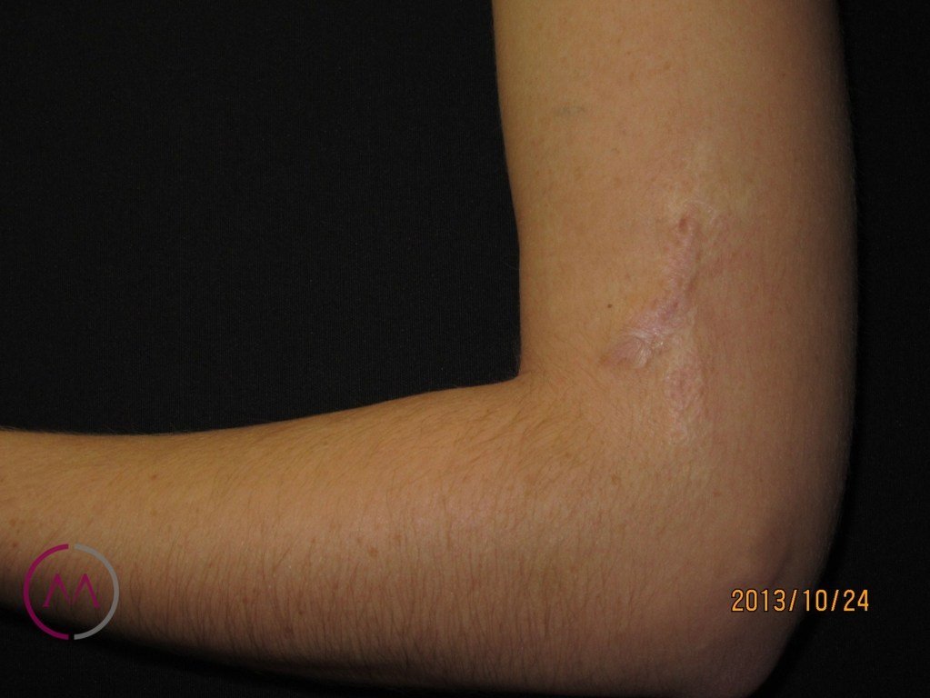 After image