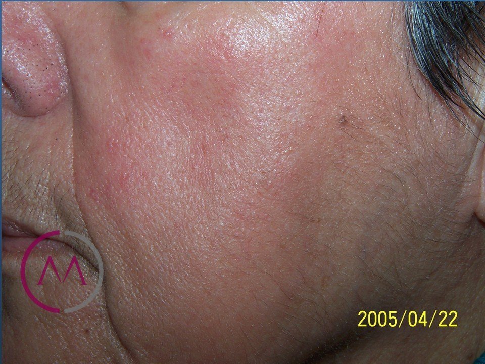 After image