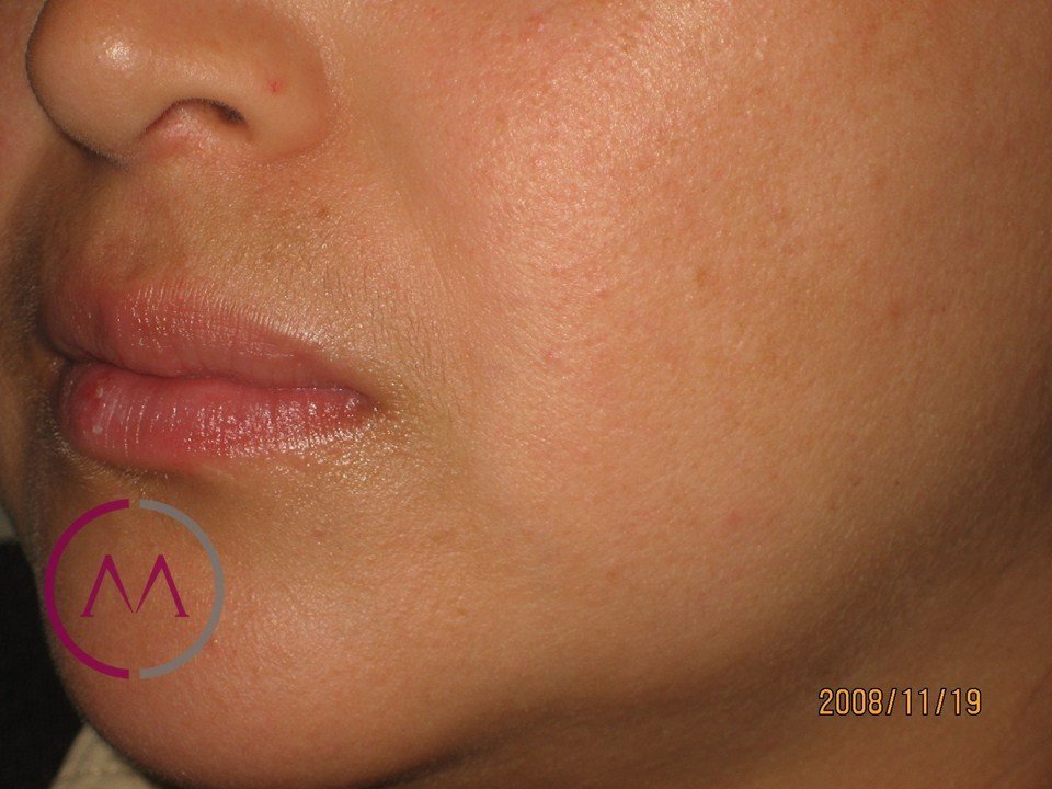 After image