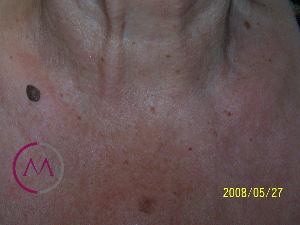 Before image