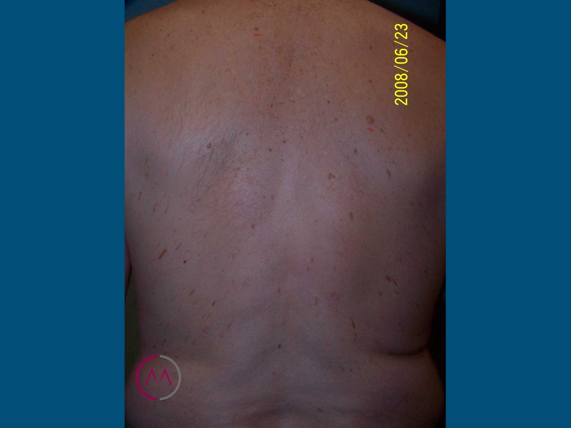 Before image