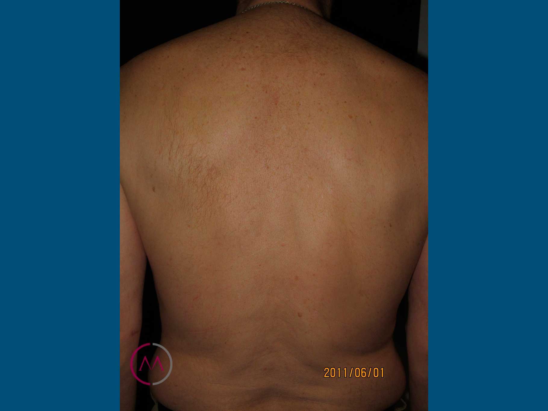 After image