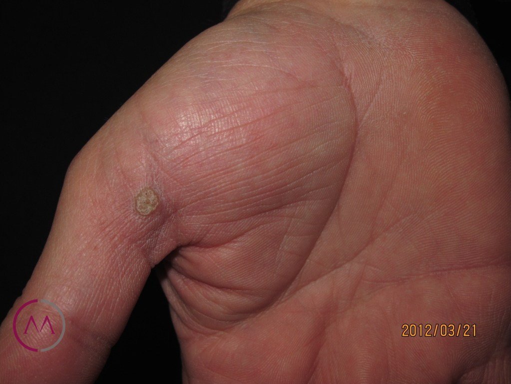 Before image