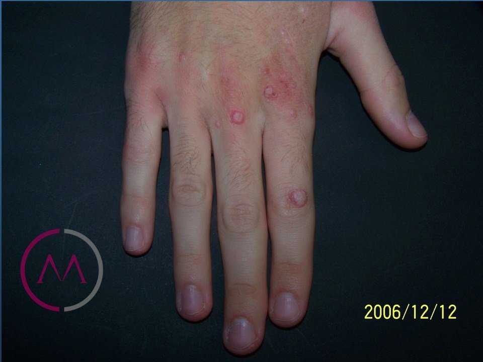 Before image