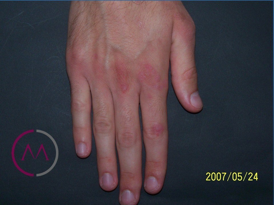 After image
