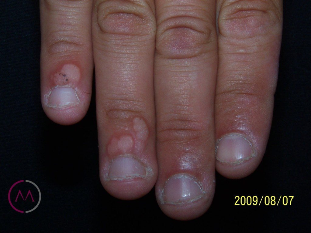 Before image