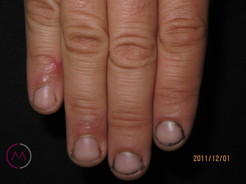 After image