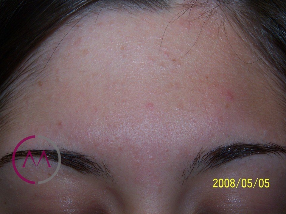 Before image
